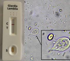 Feclab Giardia Test